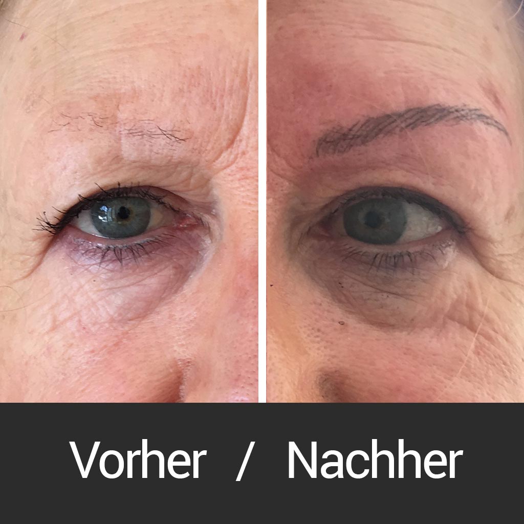 Permanent Make Up Vorher Nacher Attraktiva